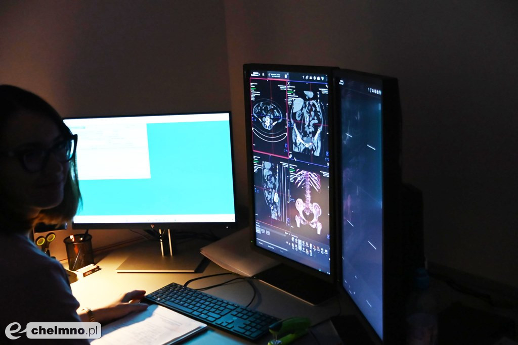 Oficjalne otwarcie pracowni Tomografii Komputerowej w ZOZ w Chełmnie