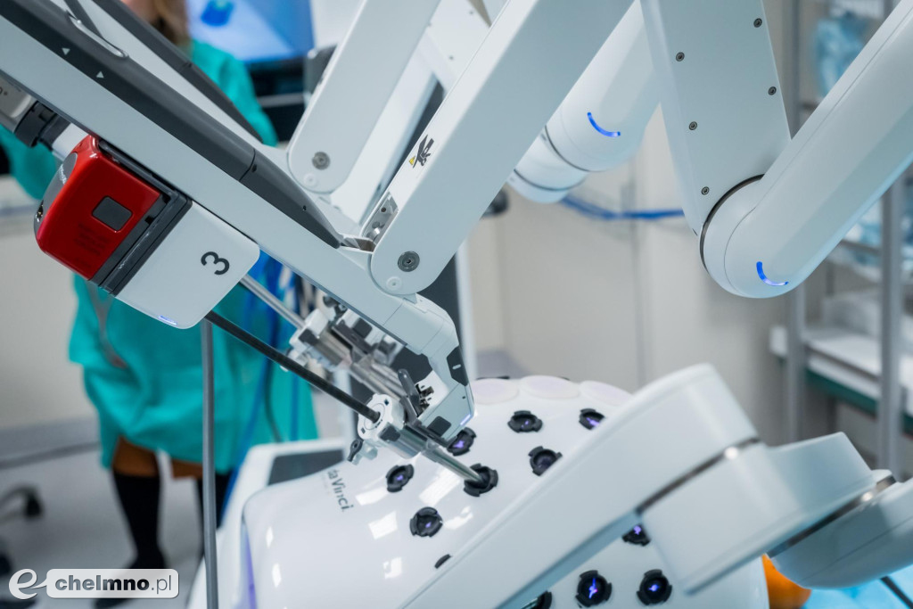 Marszałkowskie Centrum Onkologii jest krajowym liderem chirurgii robotycznej